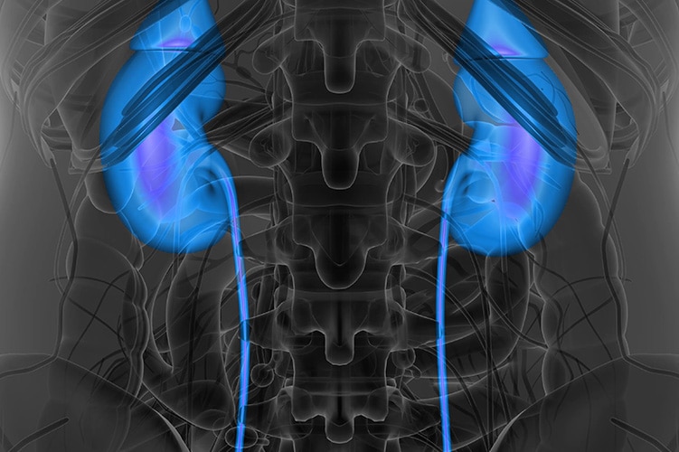 xray view for urology appointment
