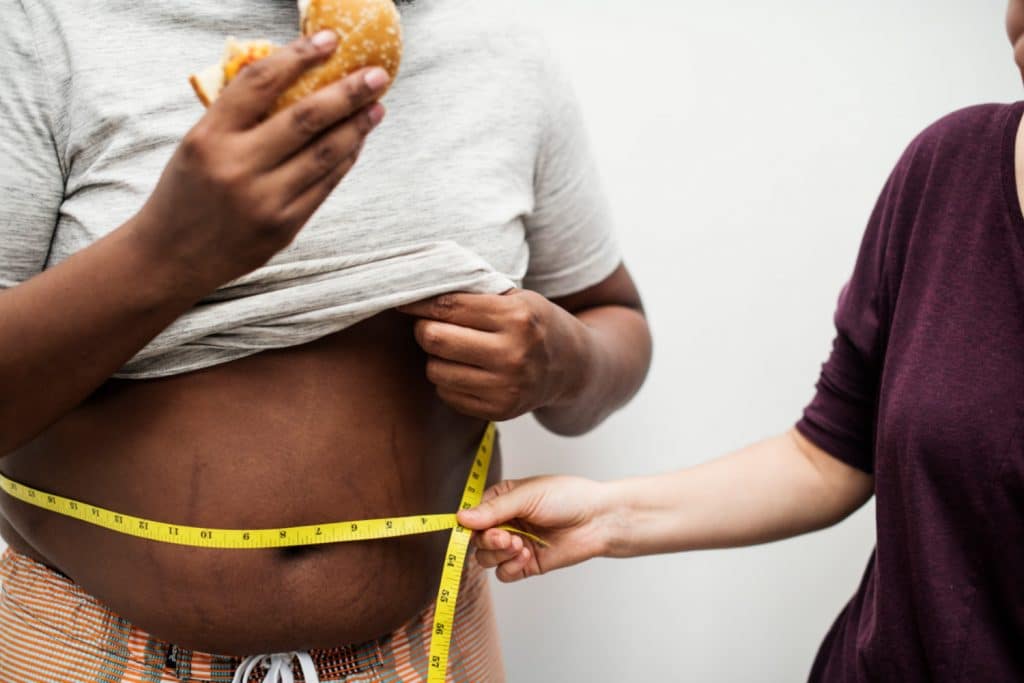 Overweight man eating a hamburger being measured for weight loss - Maiden Lane Medical, NY