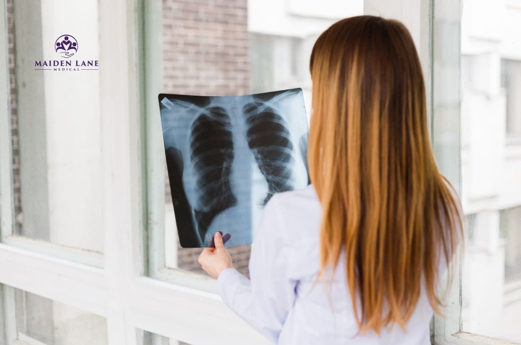 A bronchitis specialist in Manhattan, NY examining a chest x-ray.